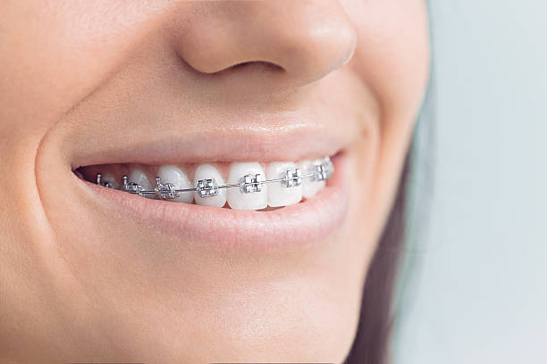 Best Wisdom Tooth Removal  in Lanham, MD